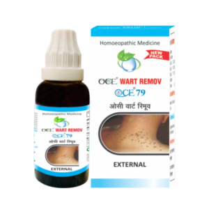 OCE WART REMOV EXTERNAL